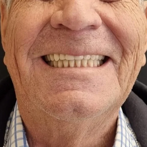 Resultado de tratamento — caso 4